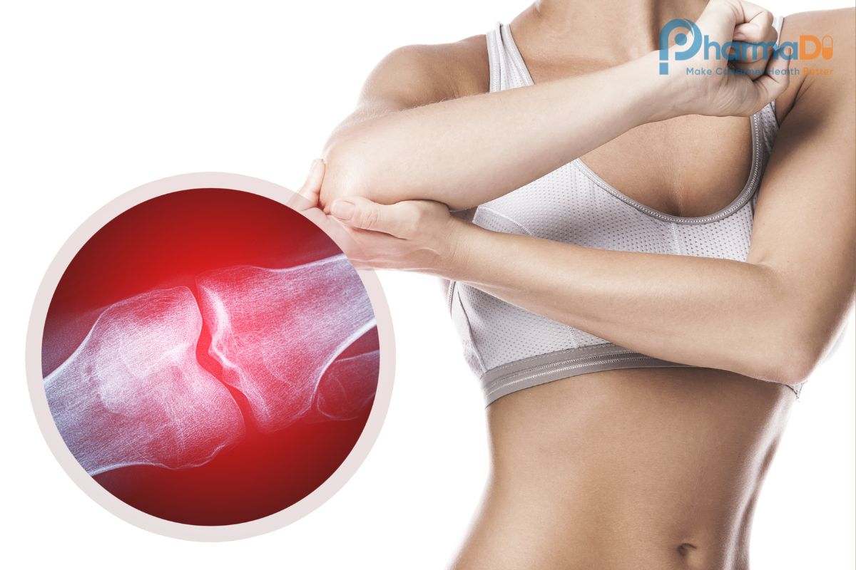 8 Nhóm Thực Phẩm Hỗ Trợ Xương Khớp Cho Người Bệnh Hiệu Quả Dược Sĩ Nhà Thuốc Cần Biết 