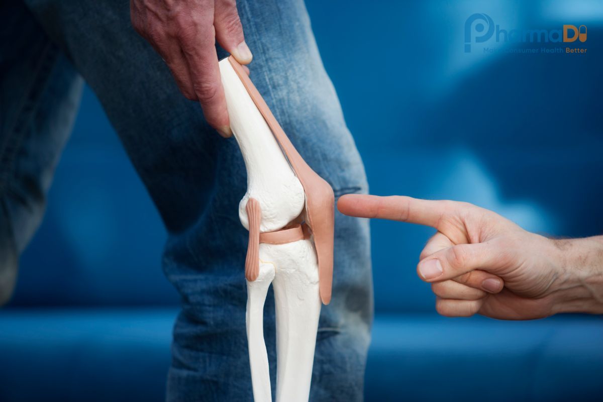 Thoái Hóa Khớp Là Gì? Nguyên Nhân, Triệu Chứng Và Cách điều Trị Dược Sĩ Nhà Thuốc Cần Biết