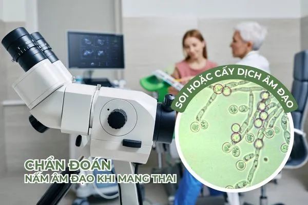 Có nhiều phương pháp khác nhau giúp bác sĩ chẩn đoán nấm âm đạo khi mang thai