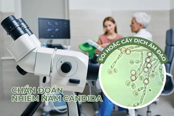 Mẫu dịch tiết âm đạo có thể góp phần chẩn đoán nấm âm đạo