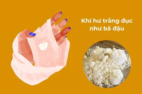 Khí hư trắng đục như bã đậu thường liên quan đến nấm âm đạo