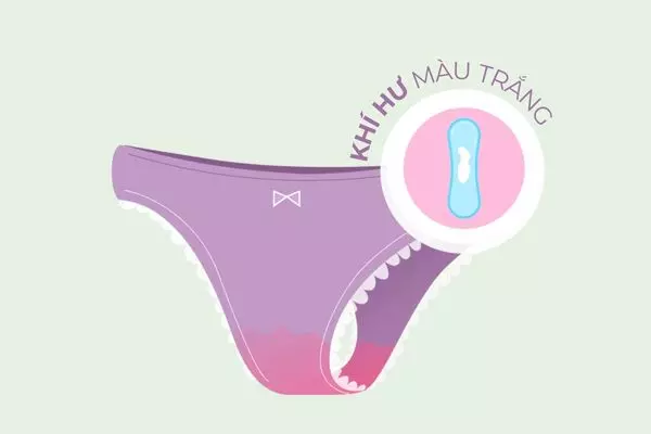 Khí hư màu trắng có thể xuất hiện do nhiễm nấm Candida âm đạo