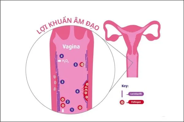 Lợi khuẩn âm đạo là những vi sinh vật tốt giúp bảo vệ sức khỏe vùng kín