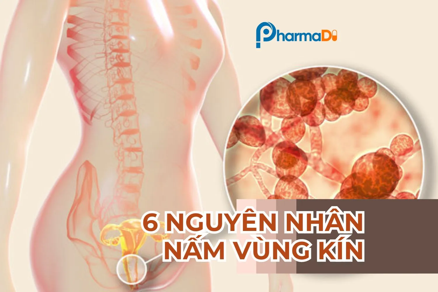 Nguyên nhân bị nấm vùng kín