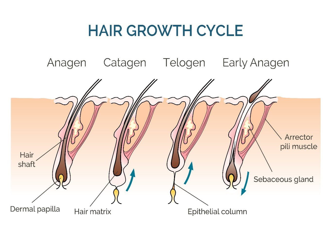 Rụng Tóc Nội Tiết Androgen