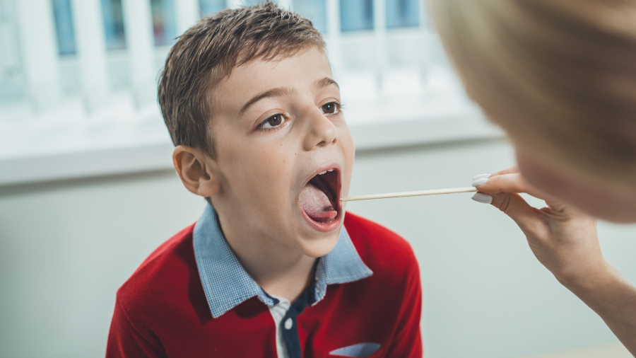 Viêm họng liên cầu khuẩn là một bệnh nhiễm khuẩn